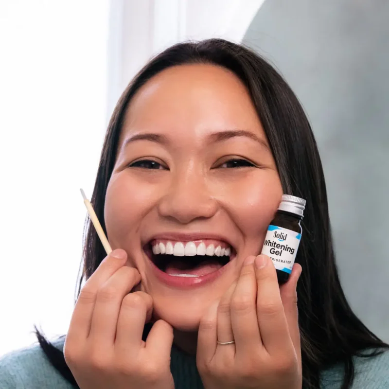 Solid Teeth Whitening - Image 3