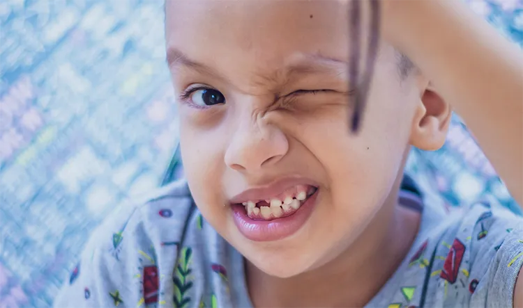 Are yellow teeth unhealthy teeth?