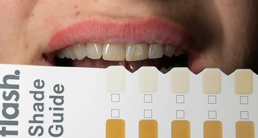 Are yellow teeth unhealthy teeth?